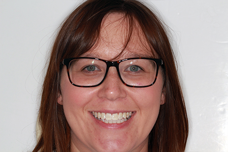 Before and After Invisalign Treatment Kingston Before and After Invisalign Treatment Kingston